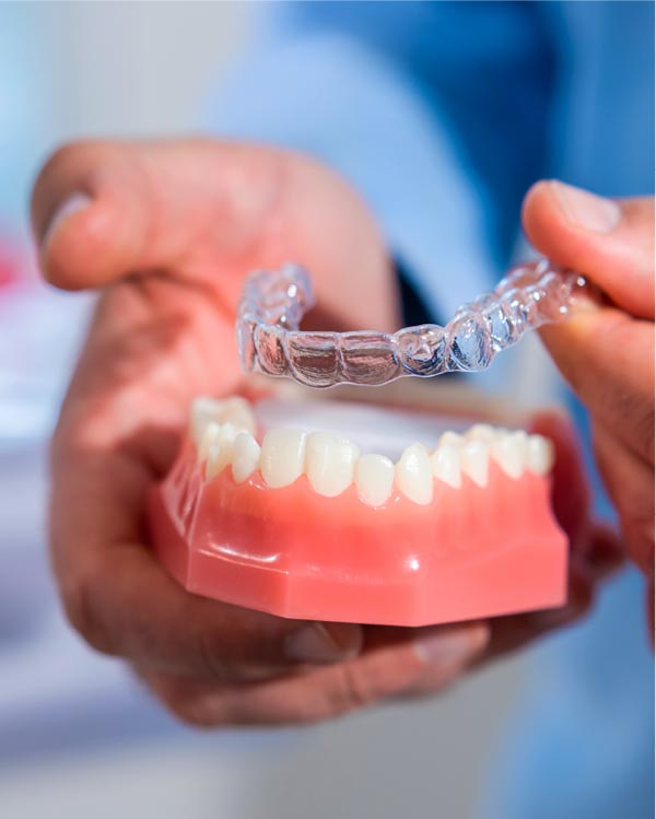 Clear aligners - Dental Services