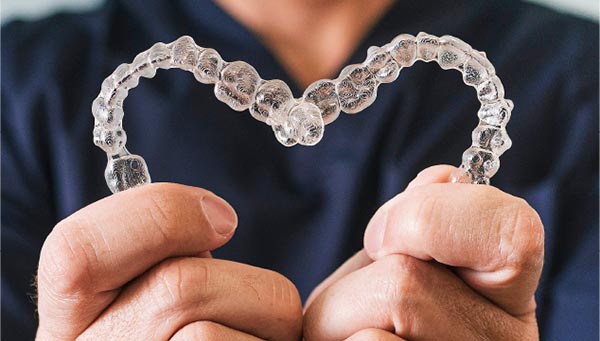 Clear aligners - Dental Services